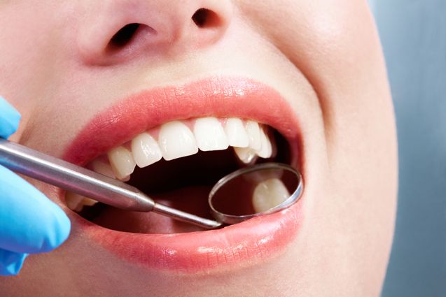 Avoid Cavities With These 5 Easy To Follow Practices