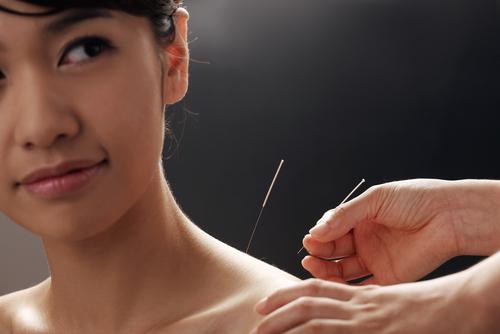 6 Conditions You Can Treat With Acupuncture