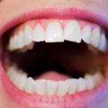 Your Teeth Can Reveal Your Overall Well-Being