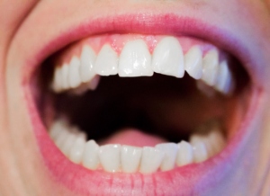 Your Teeth Can Reveal Your Overall Well-Being