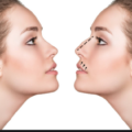X Things to Know About Aesthetic and Functional Rhinoplasty